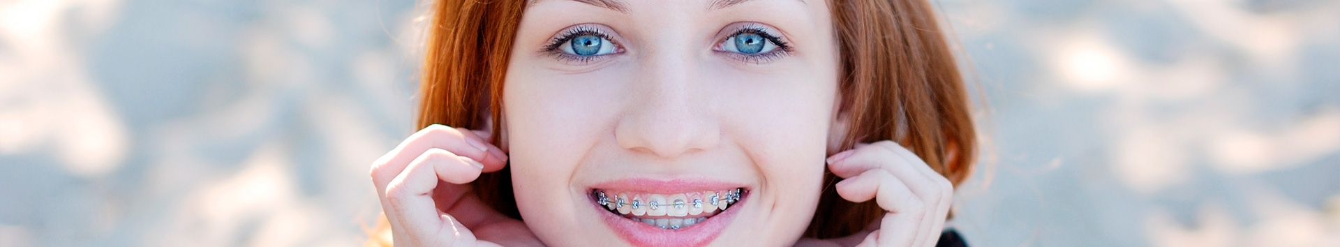 Como saber se eu preciso usar aparelho dentário realmente?