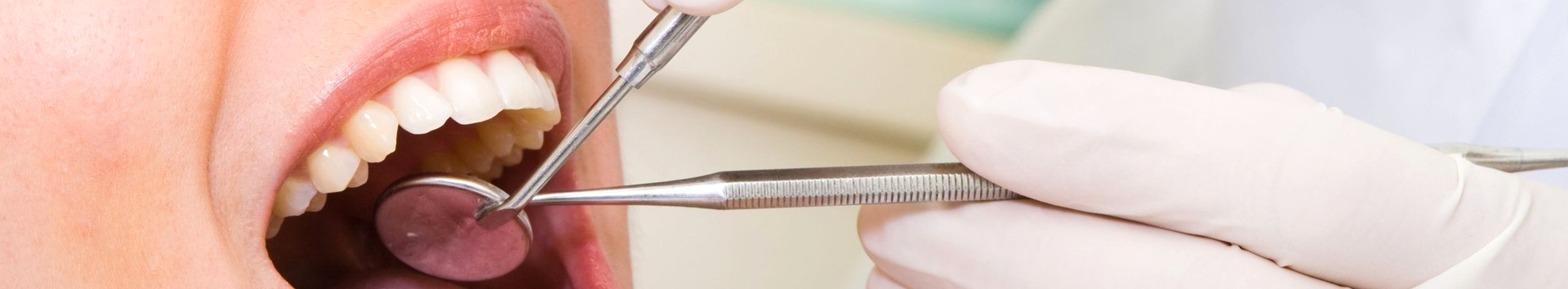 Faça o seu Implante dentário e ganhe três bens para a sua vida