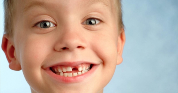 Odontologia - Guarde os dentes de leite agora e salve a vida do seu filho