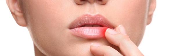 Odontologia - Muitas aftas na boca ao mesmo tempo: Leia isto agora!