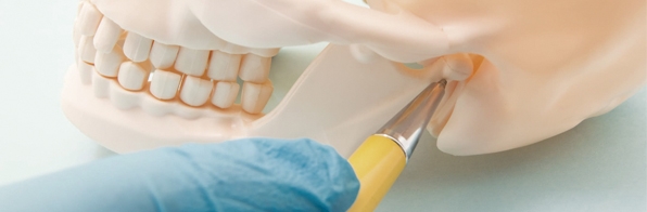Odontologia - O que é cirurgia ortognática? Um milagre real no formato rosto