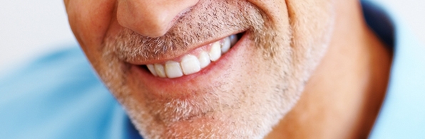Odontologia - O que uma prótese parcial removível pode fazer pelo seu sorriso?