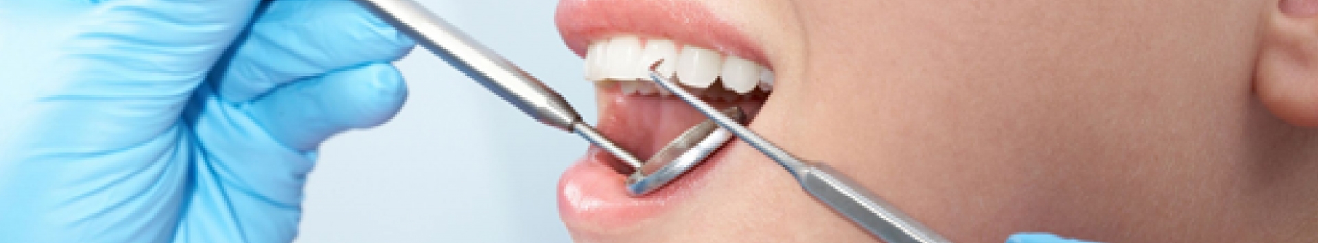 Os 3 estágios da doença Periodontal