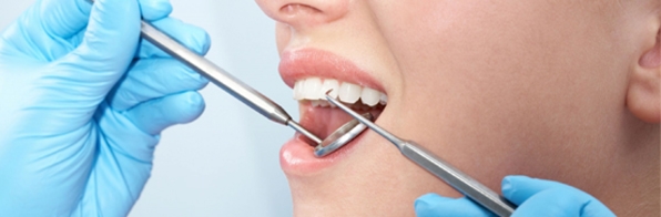 Odontologia - Os 3 estágios da doença Periodontal