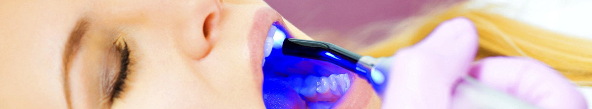 Periodontia e o tratamento a laser: Como funciona