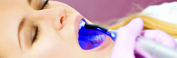 Odontologia - Periodontia e o tratamento a laser: Como funciona
