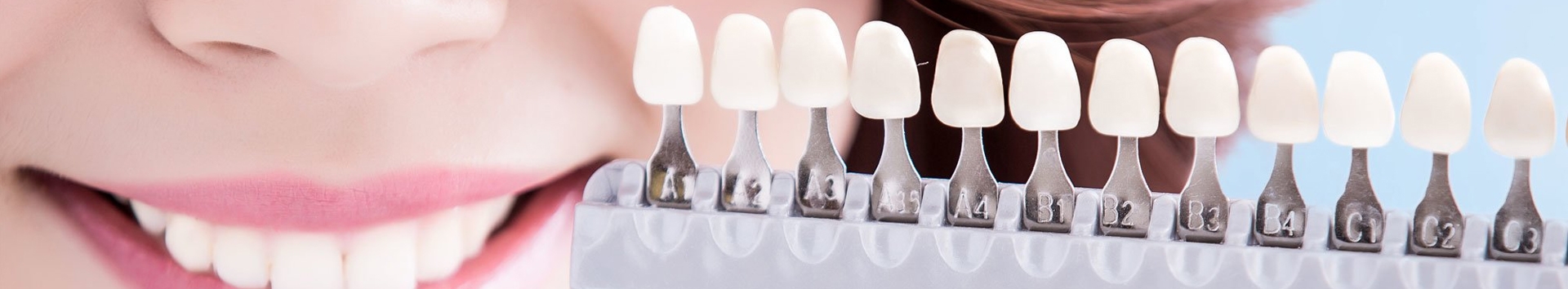 Procura por lentes de contato dental aumenta cada vez mais