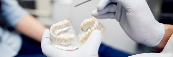 Odontologia - Prótese Protocolo: O que é, para quem é indicada e em quanto tempo dura