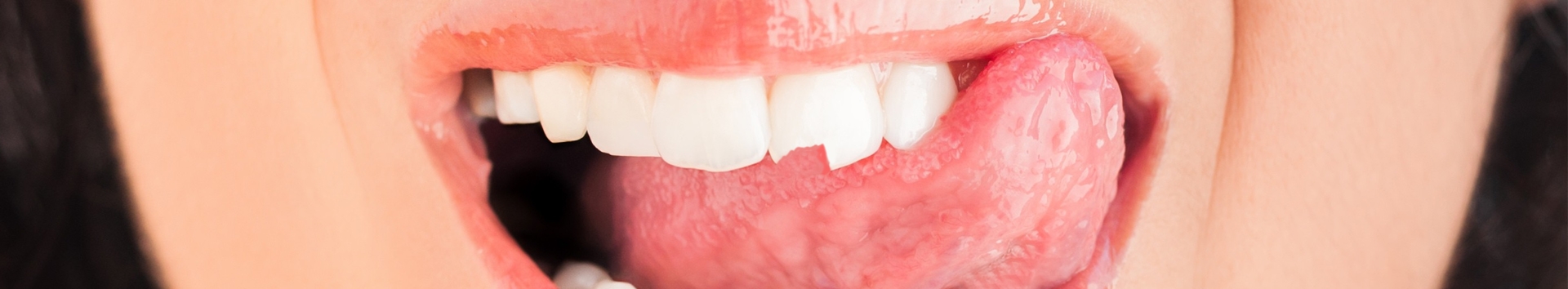 Quebrei o dente, e agora? Restauração Dentária é a sua salvação