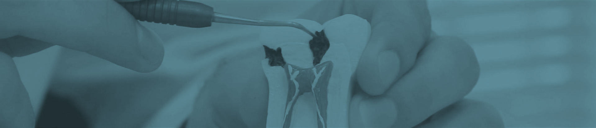 Endodontia
