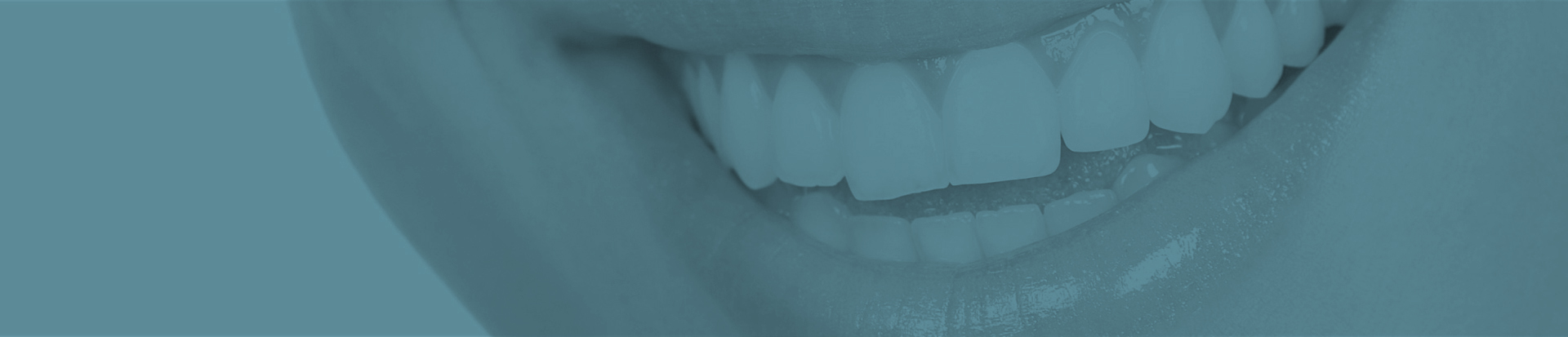 Odontologia Estética