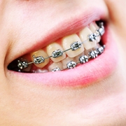 Odontologia - Ortodontia
