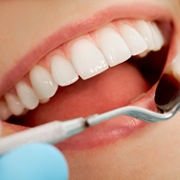 Odontologia - Plástica gengival