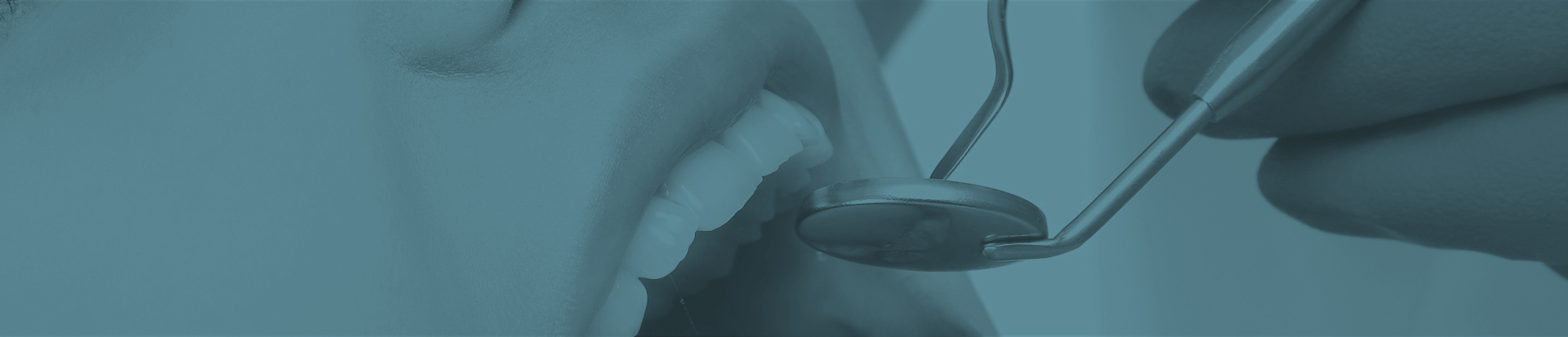 Restaurações Dentárias